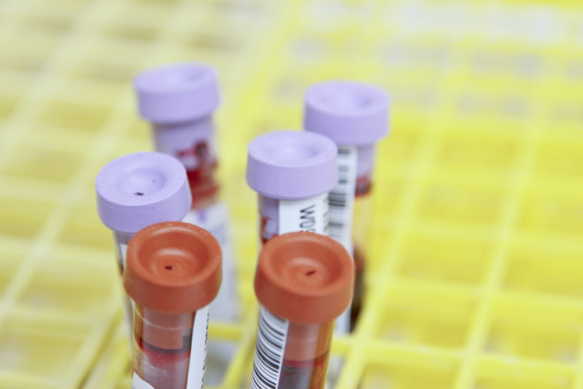 Why Retinal Screening is a Game Changer