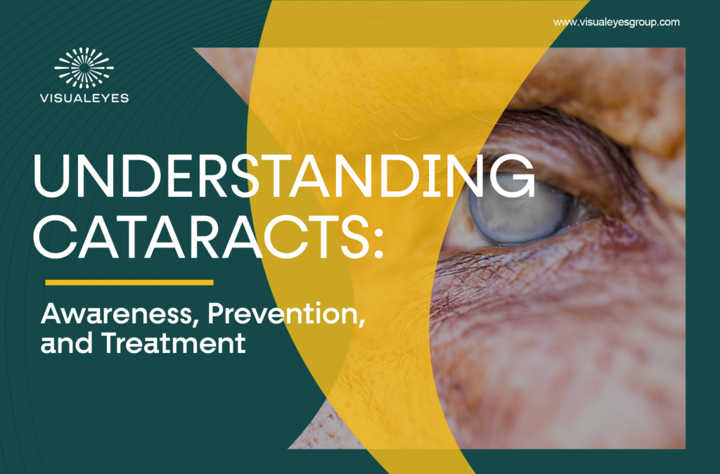 Cataracts: What Every Maryland Family Needs to Know This June